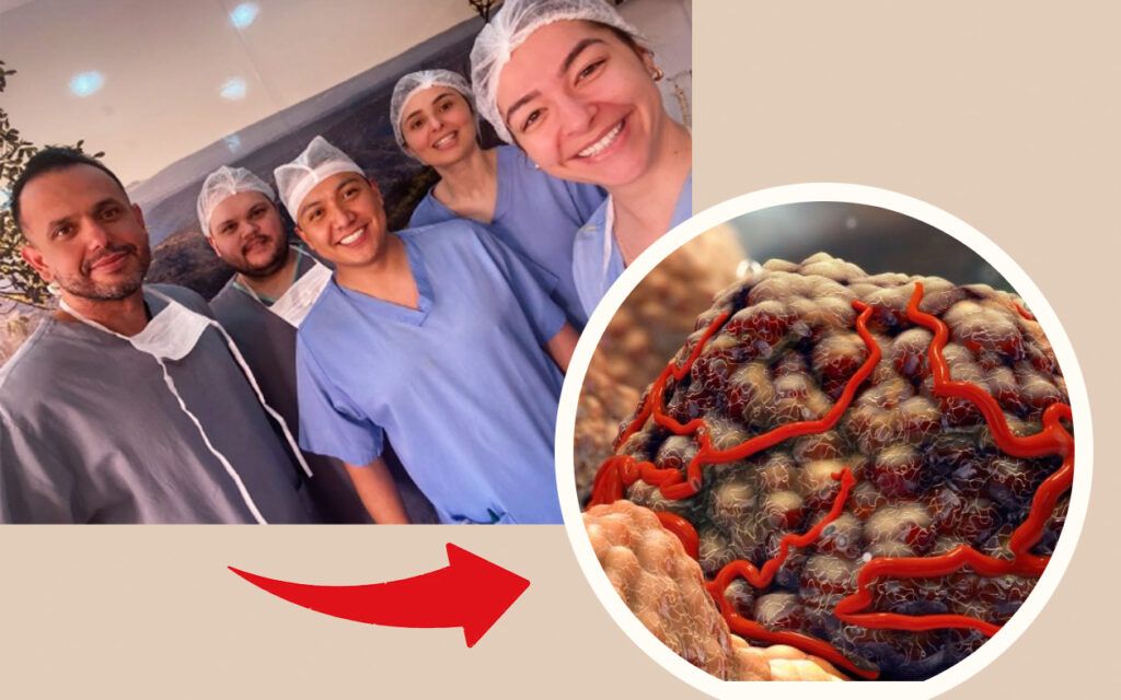 Cirurgia robótica para câncer de intestino: quais são as vantagens? 